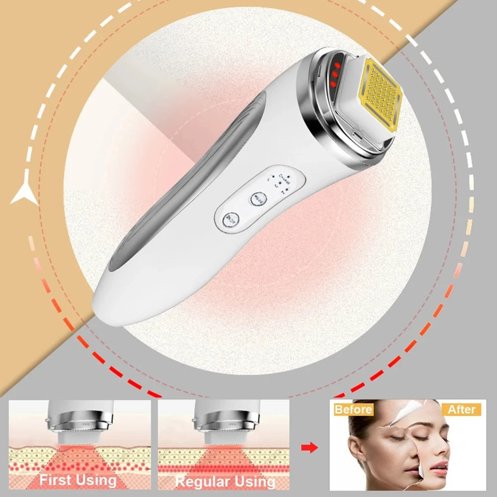 Electric Facial Lifting Machine Dot Matrix Skin Tightening Rejuvenation Wrinkle Removal Face Massager Home Use Beauty Devices