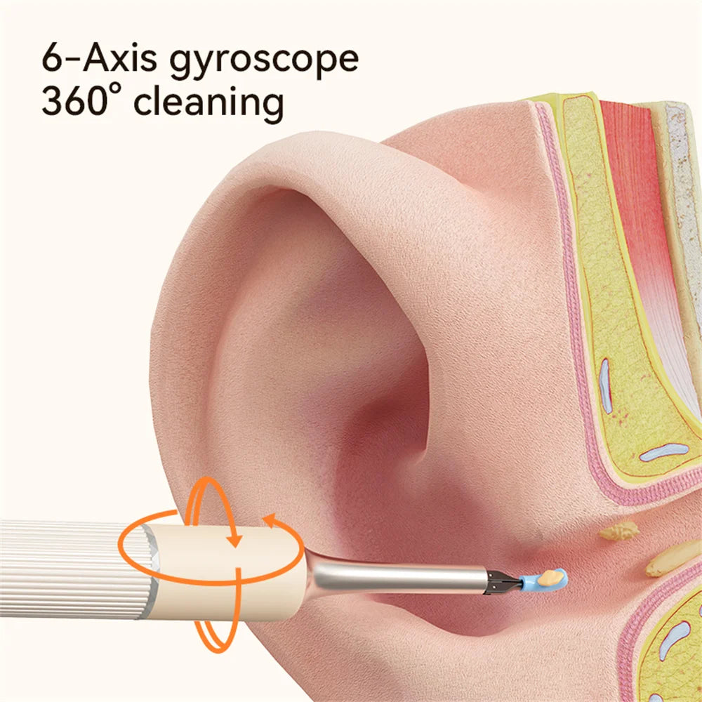 Wireless wifi endoscope smart visual ear cleaner with tweezers  Otoscope Earpick Ear Cleaner Wax Removal Camera Health Care