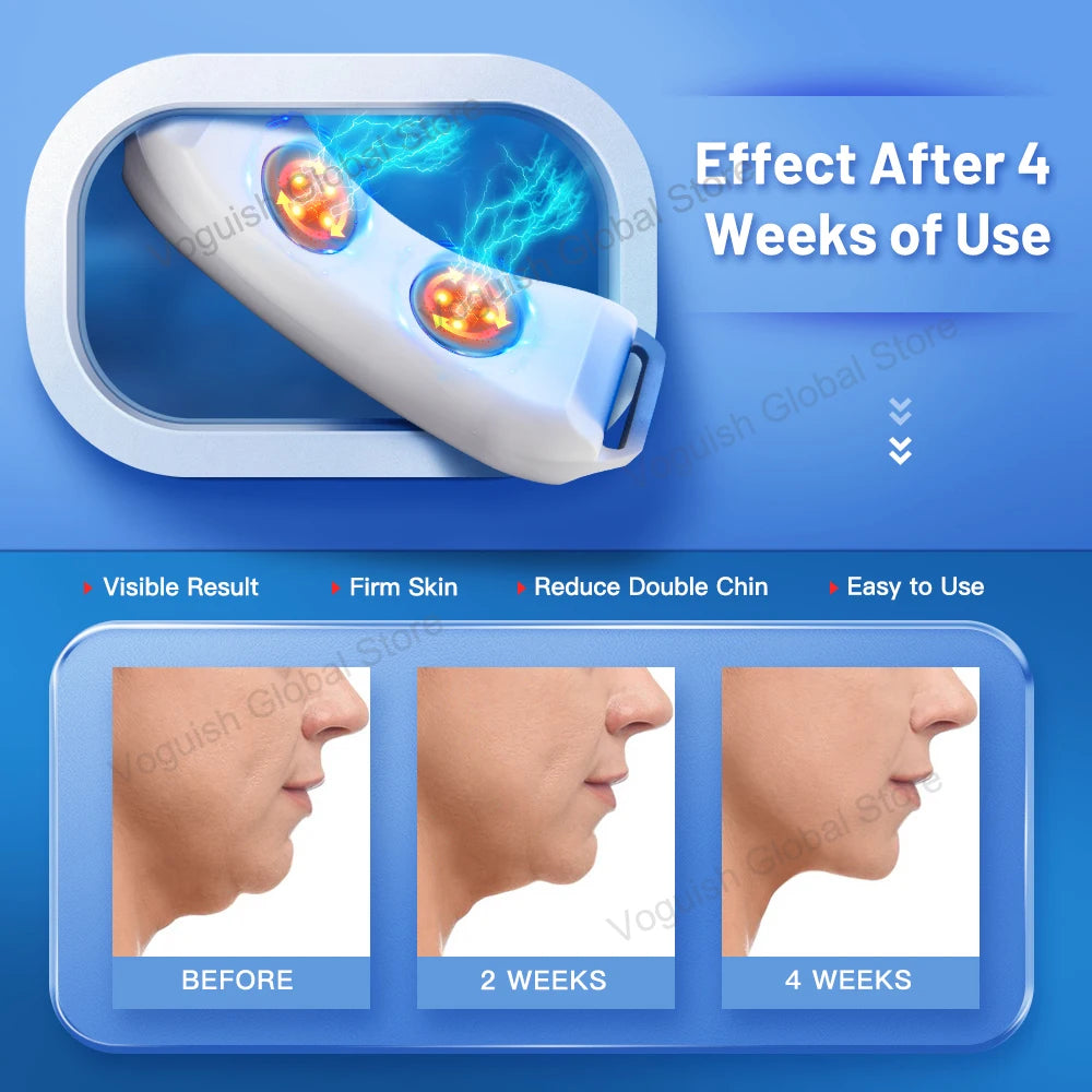 V-Line Up Facelift double chin removal beauty device