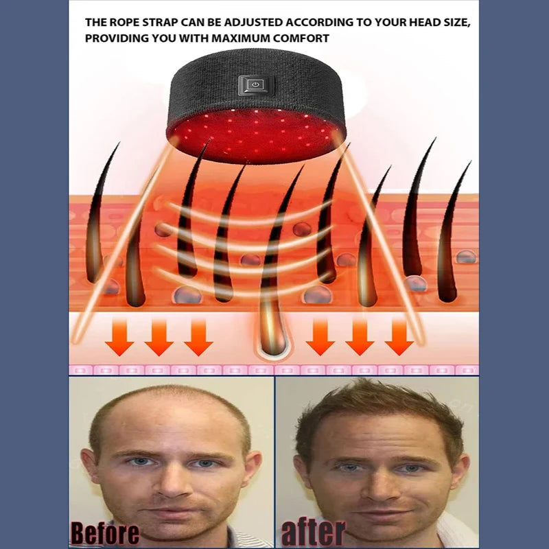 Red light therapy cap for hair loss treatment