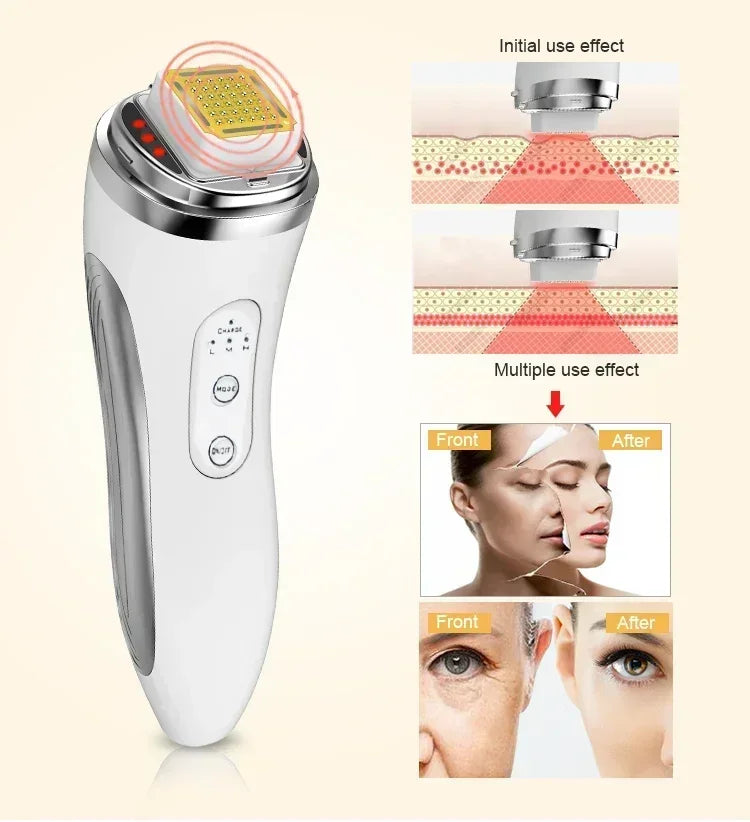 Electric Facial Lifting Machine Dot Matrix Skin Tightening Rejuvenation Wrinkle Removal Face Massager Home Use Beauty Devices