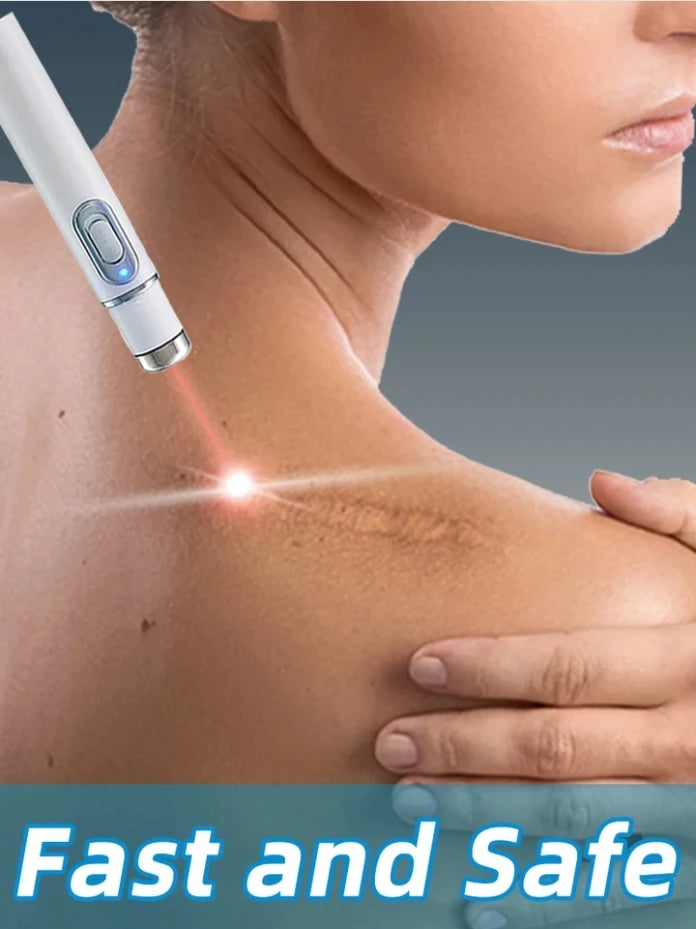 Laser pen for removing scars and wounds