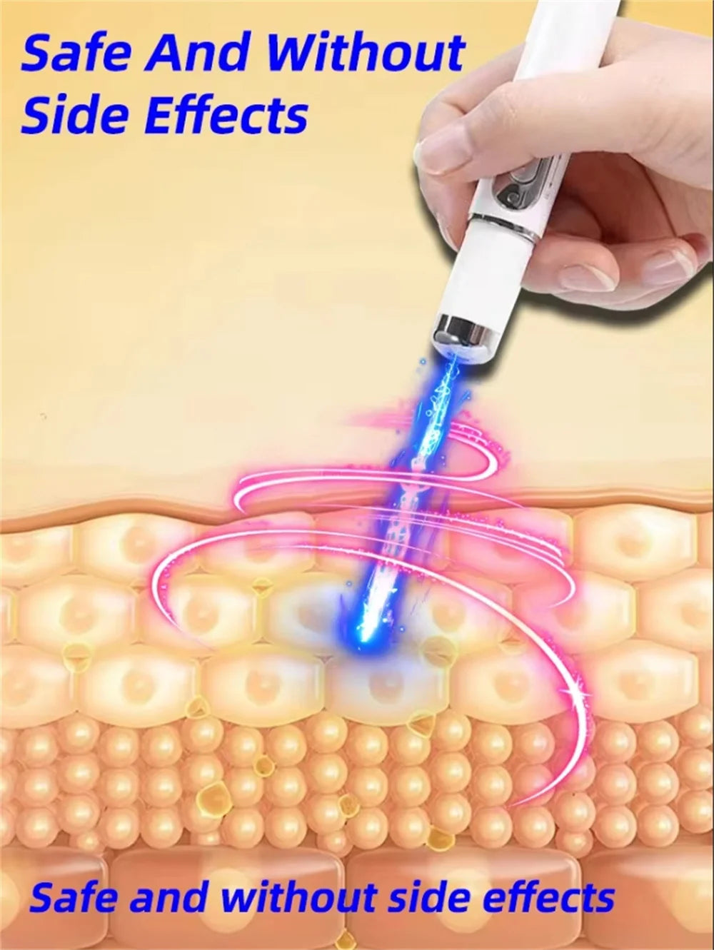 Laser pen for removing scars and wounds